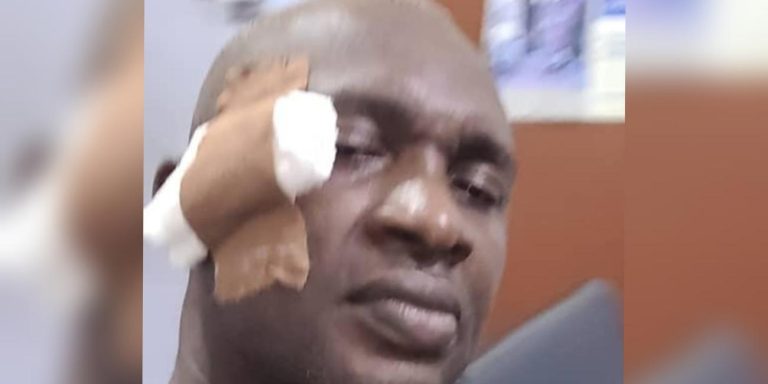 Abia State Assembly or Boxing Ring! Majority Leader Breaks Colleague’s Head With Beer Bottle in Heated Clash Over Governor Otti’s Cash Gift